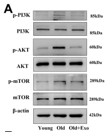 Phospho-PI3K p85 (Tyr458)[Tyr467]/p55 (Tyr199) Antibody - Fig.