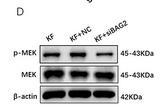 Phospho-MEK1/2 (Ser221)[Ser222] Antibody - Figure 3 Inhibition of BAG2 reduced KF migration and proliferation via the MEK signaling pathway.
