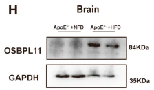 OSBPL11 Antibody - Fig.