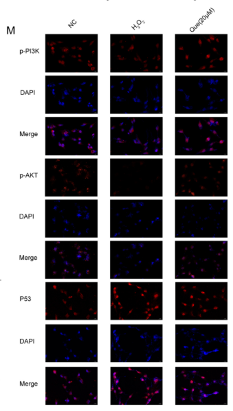 Phospho-PI3K p85 alpha (Tyr607) Antibody - FIGURE 4 Quercetin regulated apoptosis-related mRNA and protein expression of H2O2-induced KGN cell.