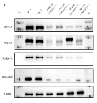 RSPH4A Antibody - Fig.