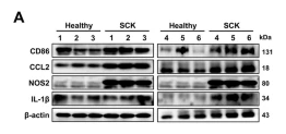 Cleaved-IL-1 beta (Asp116) Antibody - Fig.