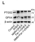 GPX4 Antibody - Figure 6 NAD+ inhibits DHEA-induced ferroptosis in PCOS mice.