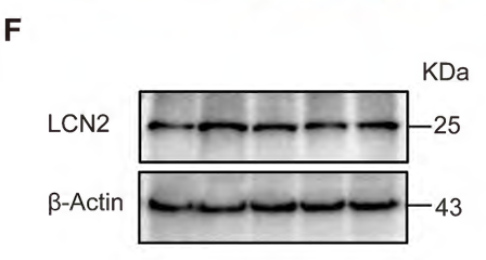 LCN2 Antibody - Figure 1.