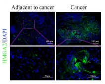 HMGA2 Antibody - Fig.