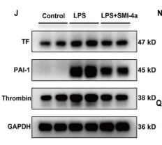 F3 Antibody - Figure 3 PIM1 inhibitor SMI-4a protects septic mice against coagulation activation and sepsis-induced acute lung injury.