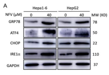 IRE1 Antibody - Fig.