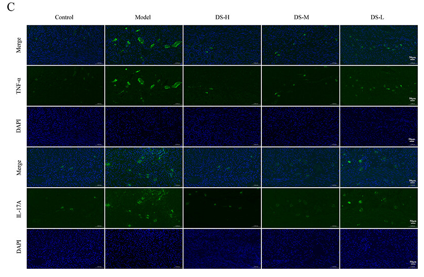 IL17A Antibody - Figure 10 qRT-PCR, WB, and IF method verification for key targets in signaling pathways.