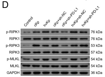 RIPK1 Antibody - Fig.
