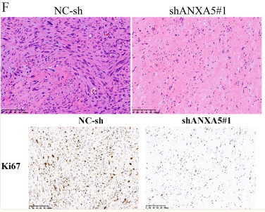 Ki67 Antibody - Figure 9.