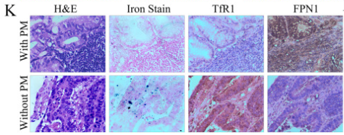 SLC40A1 Antibody - Fig.