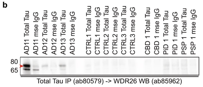 Phospho-AMPK beta 1 (Ser181) Antibody - Fig.