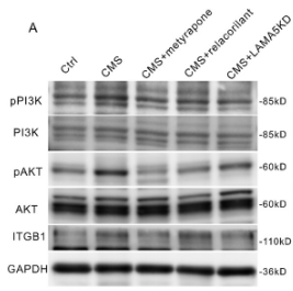 Phospho-PI3K p85 (Tyr458)[Tyr467]/p55 (Tyr199) Antibody - Figure 9 The CORT-GR-LAMA5 axis may induce cardiomyocyte hypertrophy through the ITGB1-PI3K-AKT pathway.