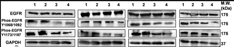 Phospho-EGFR (Tyr1173)[Tyr1197] Antibody - Figure 10.