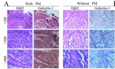 Galectin 1 Antibody - Fig.