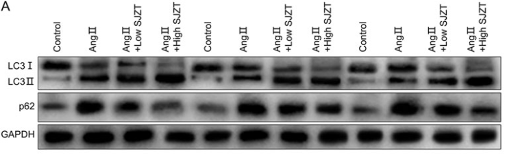 LC3A/B Antibody - Figure 8.