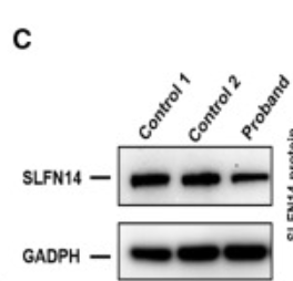 SLFN14 Antibody - Figure 3 T853fs leads to low expression level of SLFN14 (A and B) HEK293T and Meg-01 cells were transfected with SLFN14-WT or SLFN14-T853fs overexpression plasmids for 48 h.