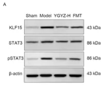 Phospho-STAT3 (Tyr705) Antibody - Figure 10.