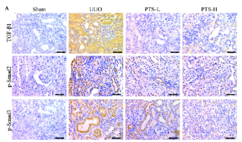 Phospho-Smad3 (Ser423+Ser425) Antibody - Figure 8.