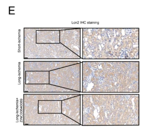LCN2 Antibody - Fig.