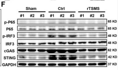 Phospho-NF-kB p65 (Ser536) Antibody - Figure 6.
