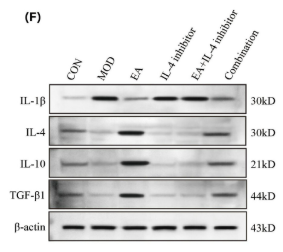 IL1 beta Antibody - FIGURE 3 Detection results of IBD-related indicators in mice of each group.