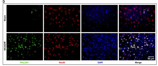 PHLDA1 Antibody - Fig.