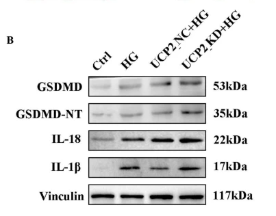 TESK1 Antibody - Fig.