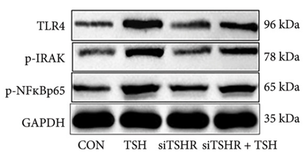 Phospho-NF-kB p65 (Ser536) Antibody - Figure 2 (e) TLR4 signaling is upregulated in TSH-stimulated hepatocytes.