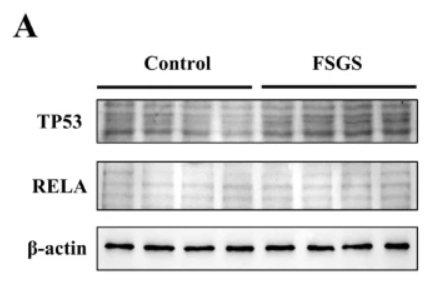 NF-kB p65 Antibody - Fig.