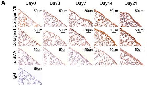 Collagen I Antibody - Figure 2 Collagen VII increased from early stage during pleural fibrotic process.