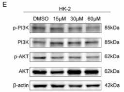 PI3K p85 alpha Antibody - Fig.