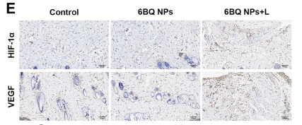 VEGFA Antibody - Fig.