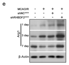 ARG1 Antibody - Fig.