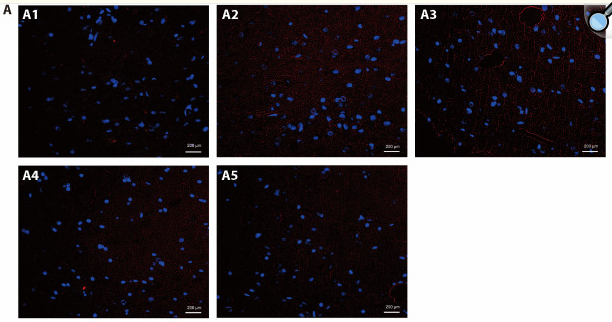 IL1 beta Antibody - Figure 4.
