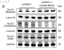 alpha Tubulin Antibody - Figure 5 Characterization of the interaction between lncRNA-MEG3 and SUZ12.