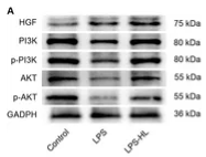 PI3K p85 alpha Antibody - Figure 6.