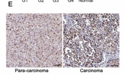 CRM1 Antibody - Fig.