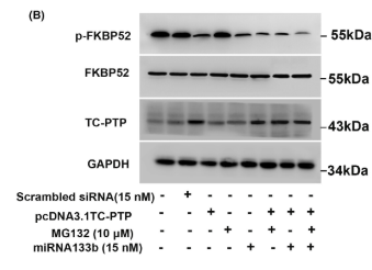 Phospho-FKBP4 (Tyr220) Antibody - FIGURE 4 The effect of miRNA133b on the second-strand synthesis of the ss-rAAV2.