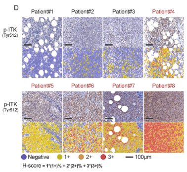 Phospho-ITK (Tyr512) Antibody - Fig.