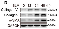 Collagen I Antibody - Figure 2 Collagen VII increased from early stage during pleural fibrotic process.