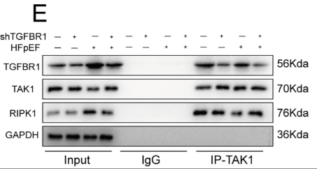 RIPK1 Antibody - Fig 4.