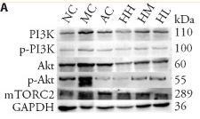 Phospho-PI3K p85 (Tyr458)[Tyr467]/p55 (Tyr199) Antibody - Figure 4.
