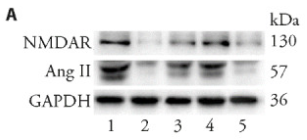 NMDAR1 Antibody - Figure 2.