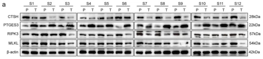 RIPK3 Antibody - Fig.