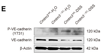 Phospho-VE-Cadherin (Tyr731) Antibody - Figure 11 CMTM3 disrupts VE-cadherin in endothelial cells of colon tissue.
