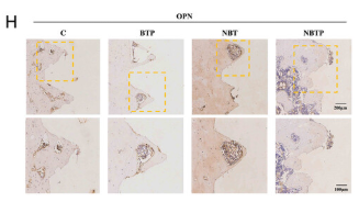 Osteopontin Antibody - Figure 9 Enhanced angiogenesis through restored mechanobiological and piezoelectric microenvironment in vivo.