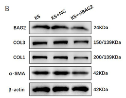alpha-SMA Antibody - Figure 2 Inhibition of BAG2 reduced keloid collagen synthesis and deposition.
