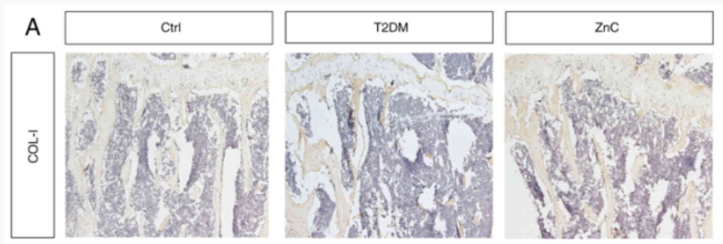Collagen I Antibody - Figure 8.