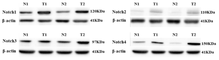 beta Actin Antibody - Fig.